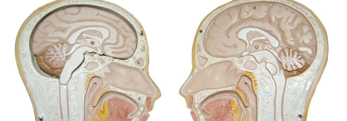 DRBD Quorum Solves Split-Brain